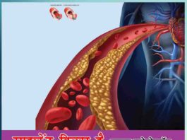 Cholesterol Kaise Kam Kare - Sachi Shiksha
