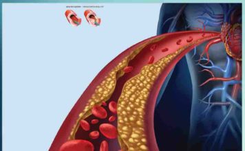 Cholesterol Kaise Kam Kare - Sachi Shiksha