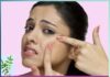 Neem Ke Patti Ke Fayde to remove pimples - Sachi Shiksha