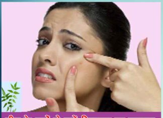 Neem Ke Patti Ke Fayde to remove pimples - Sachi Shiksha