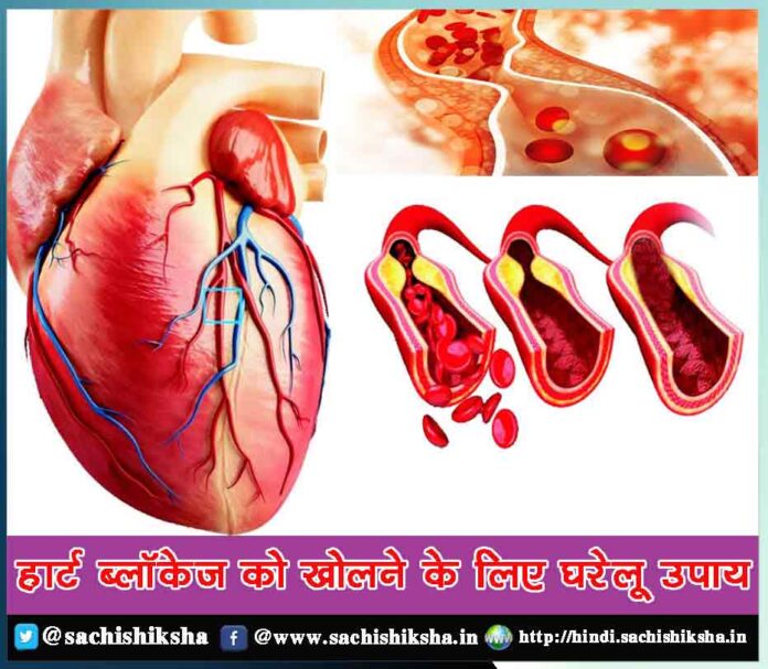 Home Remedies to Treat Heart Blockage in Hindi - Sachi Shiksha
