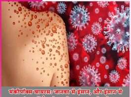 Monkeypox virus A dangerous disease that spreads from animal to human and from human to human -sachi shiksha hindi