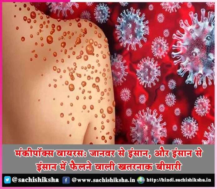 Monkeypox virus A dangerous disease that spreads from animal to human and from human to human -sachi shiksha hindi