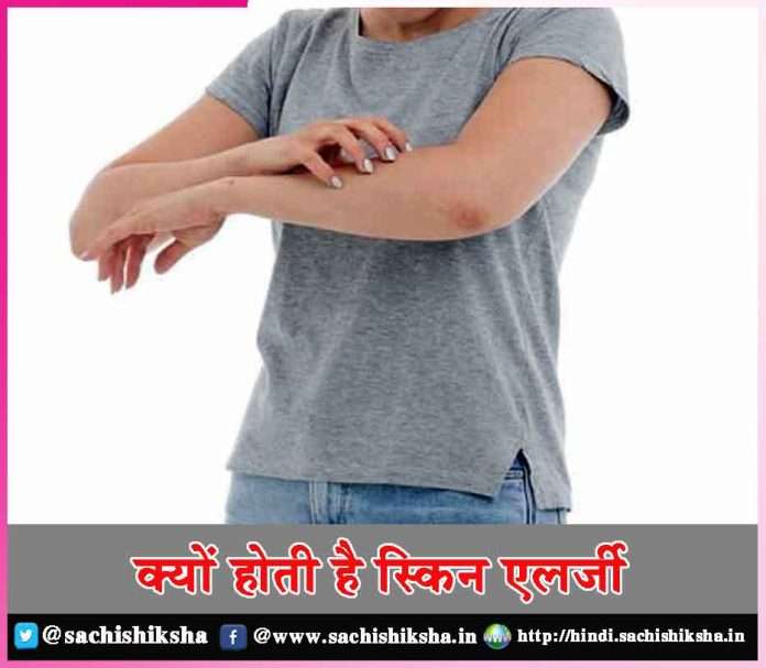 Why do skin allergies happen -sachi shiksha hindi