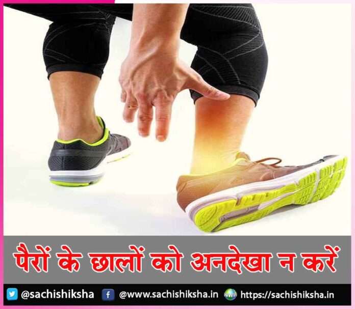 Don't ignore foot ulcers -sachi shiksha hindi