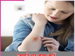 what to do if you burn -sachi shiksha hindi