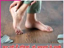 Heels: फट रही हैं एड़ियां, तो अपनाएं ये नुस्खे Heels