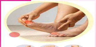Diabetes Foot: मधुमेह करें बचाव, ताकि न हों पैरों से जुड़ी समस्याएं Diabetes Foot