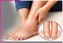 Swelling feet: पैरों की सूजन आराम देंगे प्राकृतिक उपाय Swelling feet
