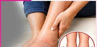 Swelling feet: पैरों की सूजन आराम देंगे प्राकृतिक उपाय Swelling feet