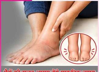 Swelling feet